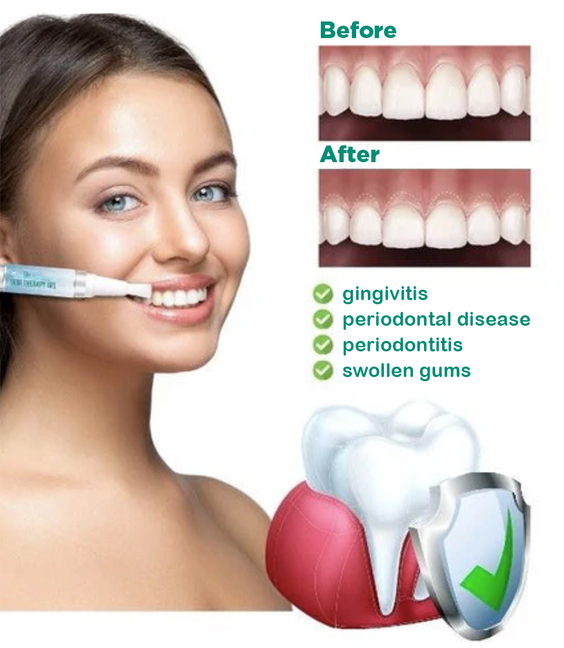 Teeth Whitening Pen